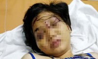 21 ngày sống trong 'địa ngục' của cô gái 9X bị tra tấn đến sẩy thai