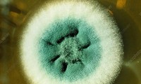 Nấm Aspergillus fumigatus được quan sát bằng kính hiển vi. Ảnh: sciencephoto.com