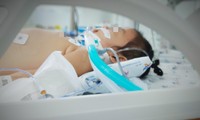 Bé gái nhập viện trong tình trạng nguy kịch phải hỗ trợ thở máy, điều trị tích cực
