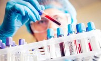 Tìm ra liệu pháp tiêu diệt 99,99% SARS-CoV-2