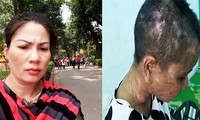 Tin mới nhất vụ nữ giúp việc 9X bị chủ tra tấn như thời trung cổ