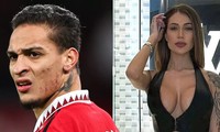 Ngôi sao của MU bị loại khỏi tuyển Brazil vì nghi án hành hung bạn gái cũ