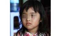 Bé H.T.N. (4 tuổi) kể bị cô giáo bạo hành rất dã man - Ảnh: VTC News