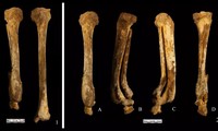 Bộ xương cổ đại tiết lộ hình phạt chặt chân phụ nữ Trung Quốc 3.000 năm trước