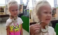 Chơi với rắn trong sở thú an toàn ở Nga, cô bé 5 tuổi bất ngờ bị rắn cắn vào mặt