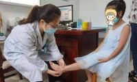 Bị mẹ bắt nhảy dây 3.000 lần/ ngày cho cao lên, cô bé ở Trung Quốc đau khớp nghiêm trọng