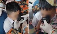 Cậu bé 7 tuổi ở Malaysia bị mắc kẹt môi trong miệng bình nước, được “giải cứu” thế nào?