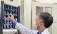 Lần đầu tiên tại Việt Nam: Phẫu thuật nội soi &apos;làm mới&apos; khớp cổ tay