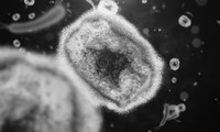 Bệnh đậu mùa khỉ: Có giống thủy đậu không, vắc xin hiệu quả đến đâu?