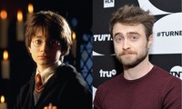 Daniel Radcliffe tiết lộ phản ứng bi hài của fan khi biết “Harry Potter” đã hơn 30 tuổi