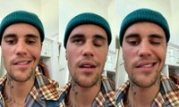 Justin Bieber bị liệt nửa mặt do nhiễm vi-rút hiếm gặp, phải hủy toàn bộ show diễn