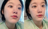 Khoe ảnh làm xấu nhưng Shuhua (G)I-DLE nhanh chóng chiếm luôn ngôi vị “nữ thần mặt mộc”