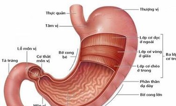 Bài thuốc hay chữa bệnh đau dạ dày – tá tràng