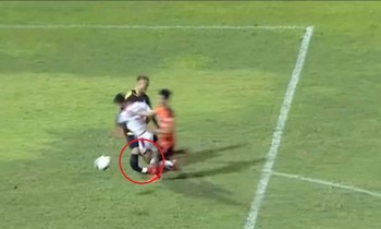 Thủ môn Đà Nẵng bị gãy cả 2 xương ống chân, nghỉ thi đấu 1 năm
