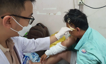 Mua chai hóa chất 75.000 đồng về thông bồn cầu, cha con ở TPHCM bỏng nát da