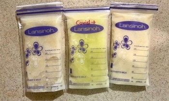Người mẹ dương tính với SARS-CoV-2, sữa mẹ chuyển màu xanh lá cây, bác sĩ nói gì?