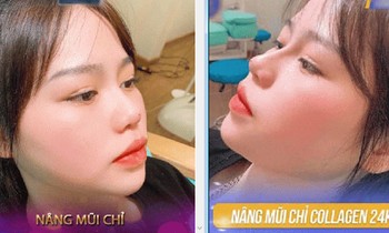 Bạn gái Quang Hải lên tiếng khi dân mạng truyền nhau ảnh cô nàng đi nâng mũi và sửa mặt