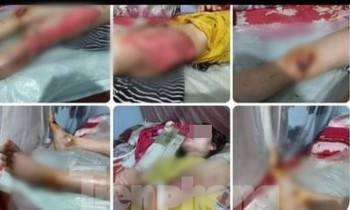 Hình ảnh người mẹ bị chấn thương do chạy bám theo xe của con trai lan truyền trên mạng xã hội.