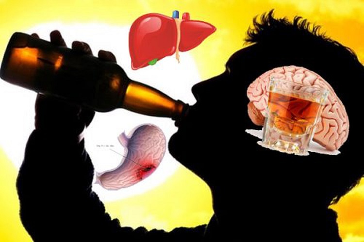 Rượu bia gây 7 loại ung thư và 200 bệnh