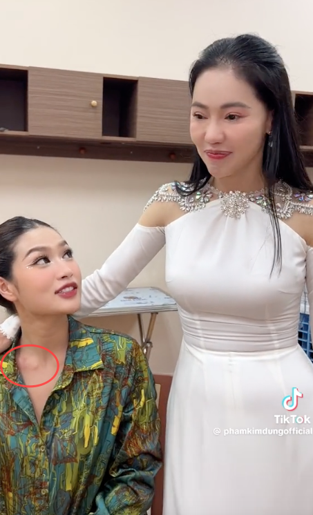 Showbiz 20/8: Trầy xước, bầm tím người vì trình diễn trang phục dân tộc ở Hoa hậu Hòa bình Việt Nam ảnh 3