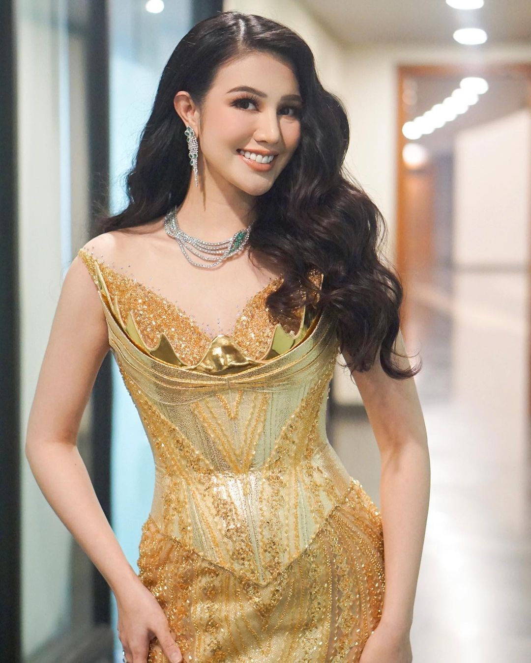 Hoa hậu đẹp nhất Thế giới bị chê xuống sắc ảnh 16