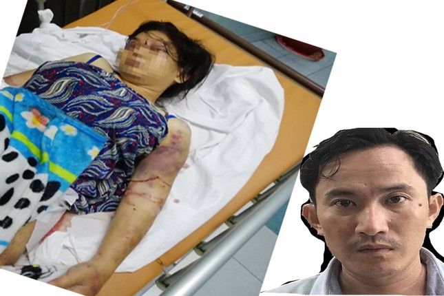 Lời khai bất ngờ của 3 nghi phạm tra tấn cô gái dã man như thời trung cổ ảnh 1