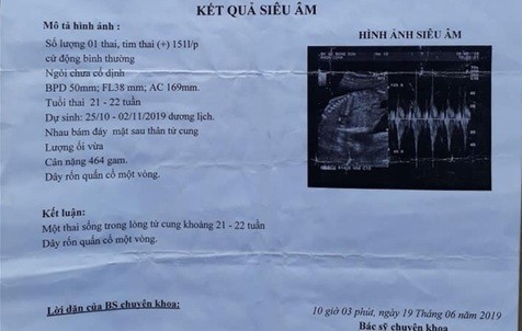 Bé gái 14 tuổi ở Bình Định bị xâm hại, mang thai 6 tháng ảnh 1
