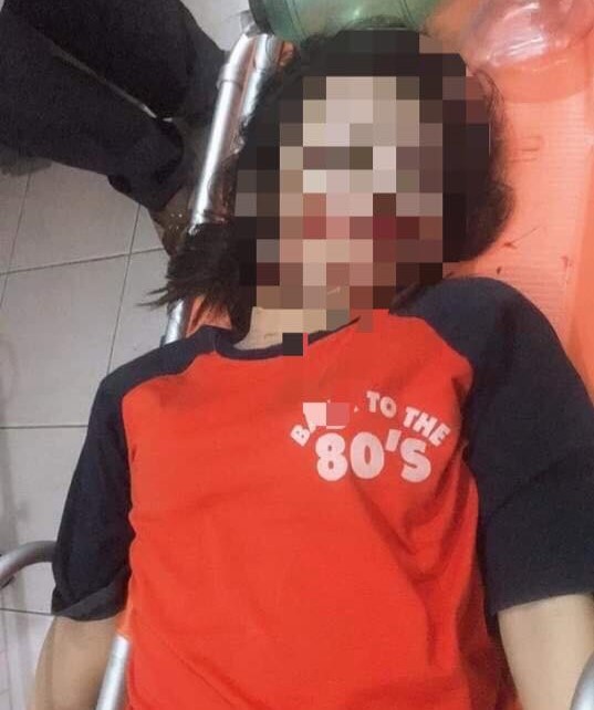Vướng phải dây điện trên đường, nữ sinh 17 tuổi tử vong ảnh 1