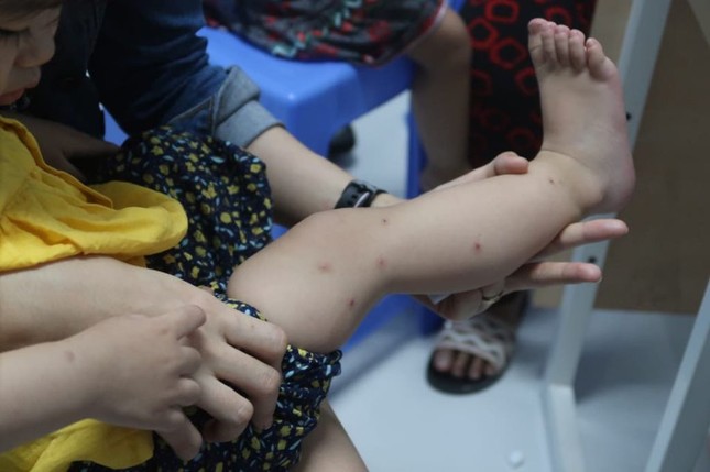 Bác sĩ nhi 'điểm mặt' bệnh thường gặp ở trẻ nhỏ khi thời tiết thay đổi ảnh 3