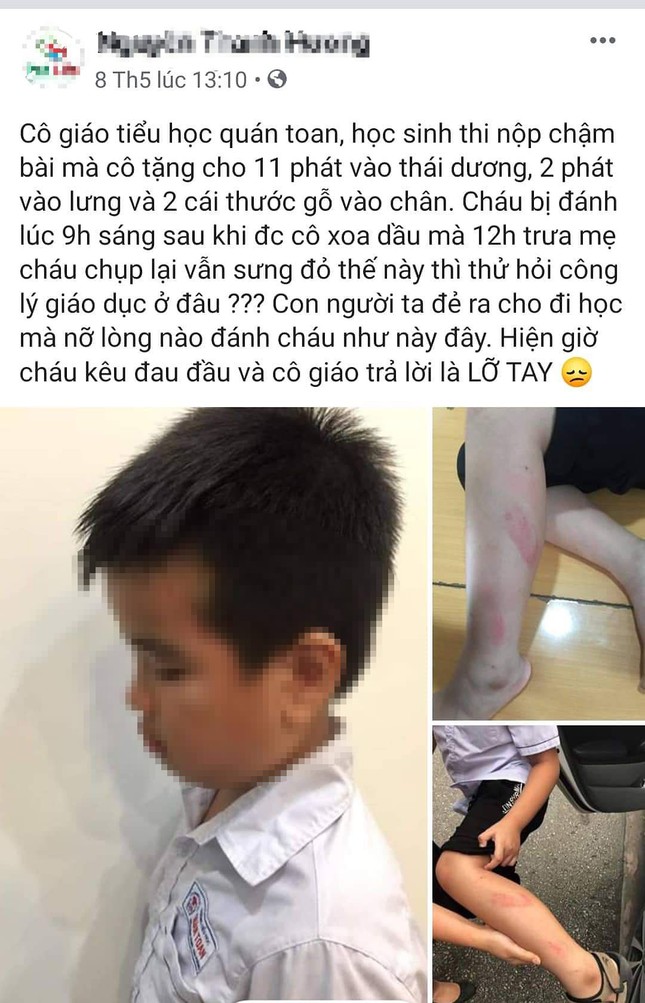 Đình chỉ công tác cô giáo Hải Phòng vụt học sinh lớp 2 đỏ chân ảnh 1