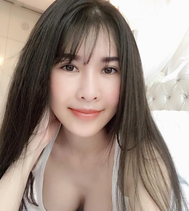 Quế Vân công khai ảnh phẫu thuật toàn bộ gương mặt ở Hàn Quốc ảnh 4