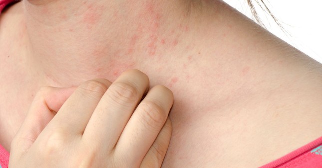 Cà chua: Cực tốt và cực độc, biết mà tránh khi ăn khỏi rước họa vào thân ảnh 4