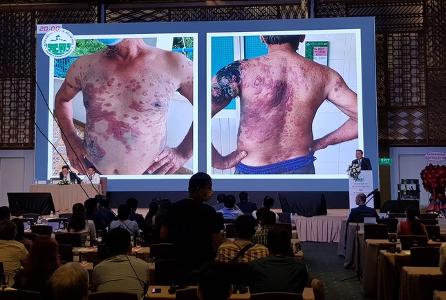 Những dấu hiệu trên da cảnh báo bệnh lý ác tính ảnh 1