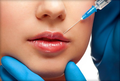 Tại sao mọi người đều tiêm filler làm đầy môi? Những khao khát dấu đằng sau mốt môi dày ảnh 1