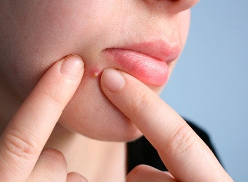 Những thói quen tưởng đơn giản nhưng lại gây hại đến nhan sắc, nên sửa ngay kẻo trễ! ảnh 4
