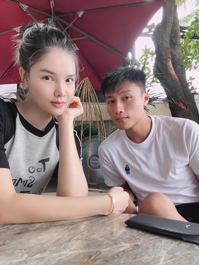 Người mẫu Kỳ Hân - vợ Mạc Hồng Quân - khủng hoảng vì khuôn mặt biến dạng do phẫu thuật thẩm mỹ ảnh 3