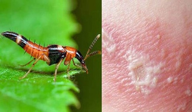 1001 thắc mắc: Loài kiến nào có nọc độc gấp 12 lần nọc rắn hổ mang? ảnh 1