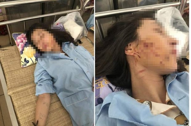 Cô gái bị 'lột đồ, đổ nước mắm' giữa phố lên tiếng ảnh 1
