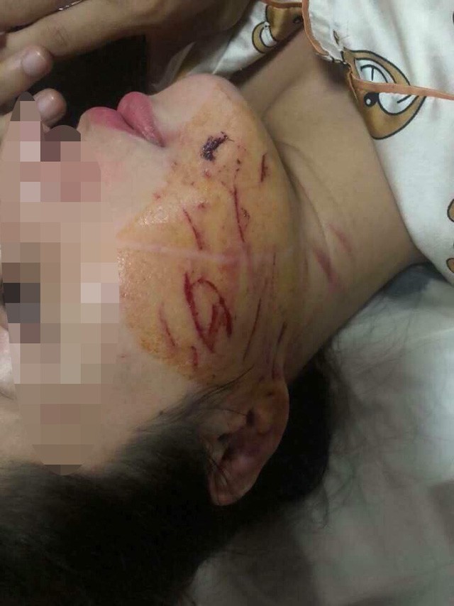 Vụ cô gái bị lột đồ, đổ nước mắm lên người: Triệu tập 2 đối tượng ảnh 1