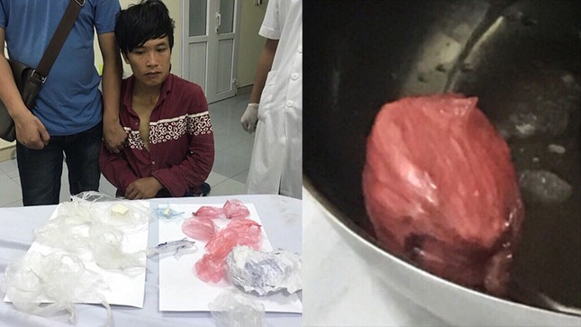12 giờ 'giải cứu' khối ma túy khủng giấu trong vùng kín ảnh 1