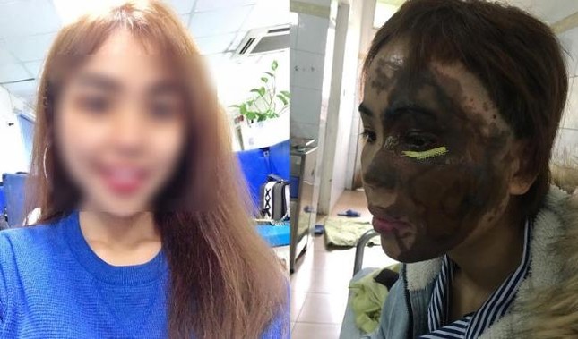 Cựu thiếu úy công an lên kế hoạch, mua can axit 30 lít để tạt vợ sắp cưới ảnh 1