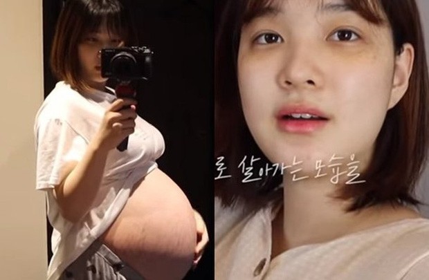 Yulhee, “bà mẹ trẻ nhất K-pop” giảm cân nhanh không tưởng sau khi sinh đôi ảnh 2