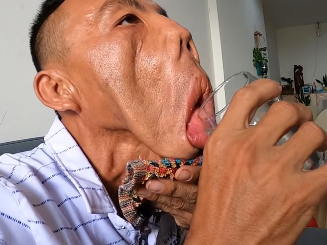 Tìm lại cuộc sống cho chàng trai 'mặt quỷ' ảnh 1