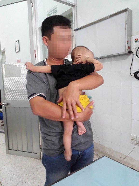 Mẹ phát hoảng vì đầu con ngày càng to do biến dạng sọ ảnh 4