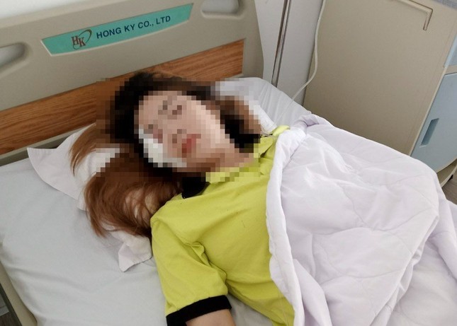Hai vợ chồng ngã xe trọng thương do bị chó dữ đuổi cắn trong khu công nghiệp ảnh 4