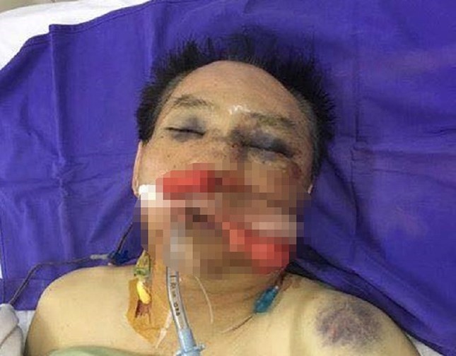 Nguyên đại tá công an bị khởi tố vì đánh anh trai, chị dâu nhập viện ảnh 1