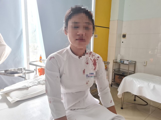 Nữ sinh dùng guốc đánh bạn cùng lớp tóe máu đầu ảnh 1