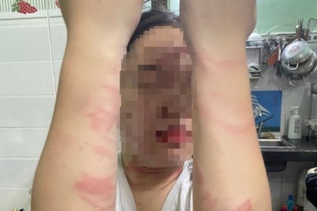 Điều tra vụ việc thiếu nữ 17 tuổi bị mẹ ruột đánh gây thương tích ở TP Thủ Đức ảnh 1