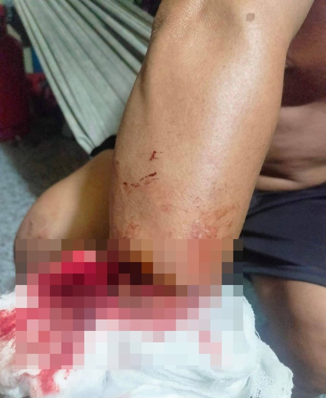 Chủ ghe bị cướp khống chế, lấy tài sản rồi bắt nấu mì tôm cho ăn ảnh 1