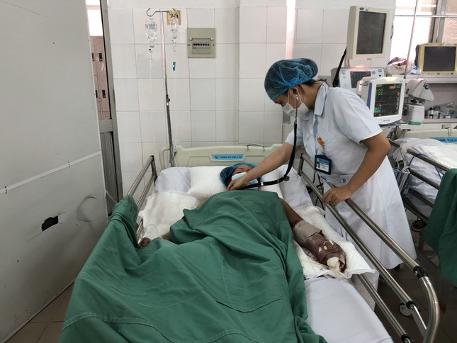 Trồng sả để phòng rắn, nào ngờ bị rắn cắn trong bụi sả ảnh 2
